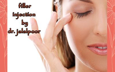 تزریق فیلر + نمونه عکس