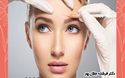 باید و نبایدهای قبل و بعد از بوتاکس
