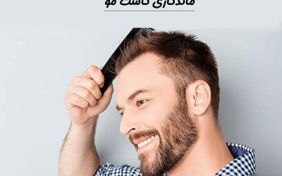 ماندگاری کاشت مو