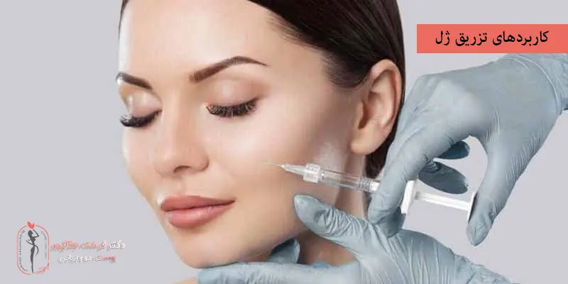 کاربردهای تزریق ژل