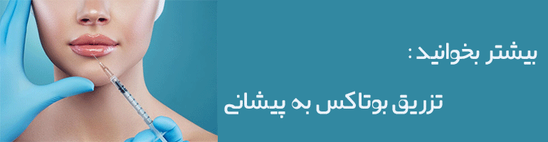بوتاکس لب