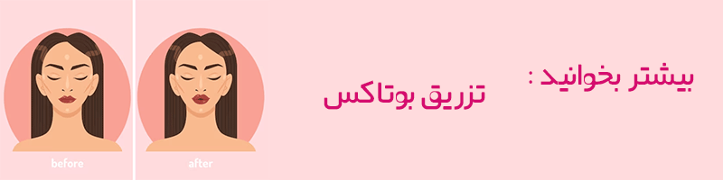 مراقبت های بعد و قبل از تزریق بوتاکس