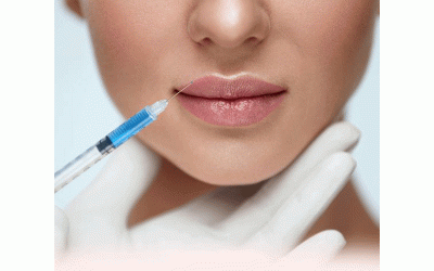 عکس تزریق ژل لب طبیعی💋
