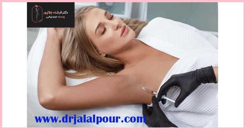 بوتاکس زیر بغل