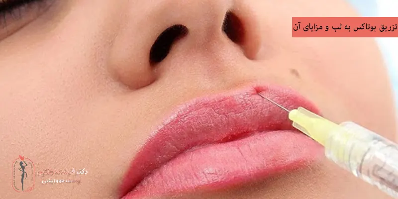 تزریق-بوتاکس-به-لب-و-مزایای-آن