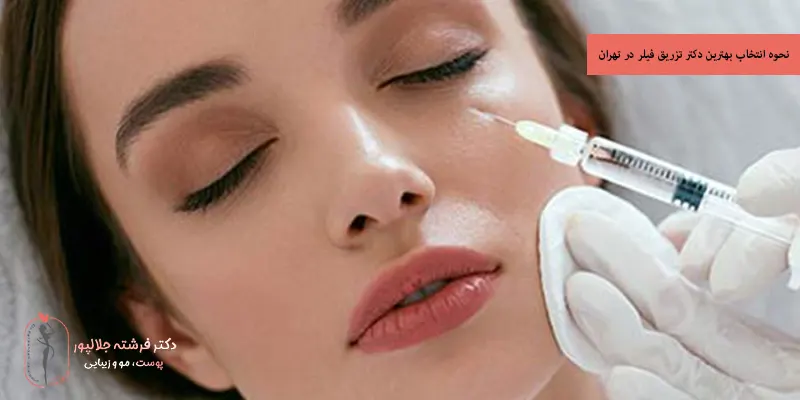 نحوه انتخاب بهترین دکتر تزریق فیلر در تهران