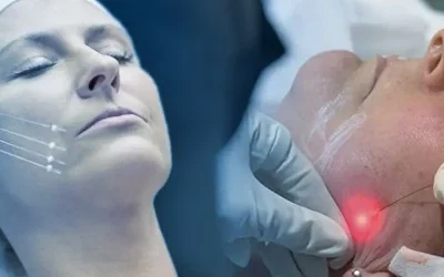 اندولیفت + مراحل، کاربردها و مزایا